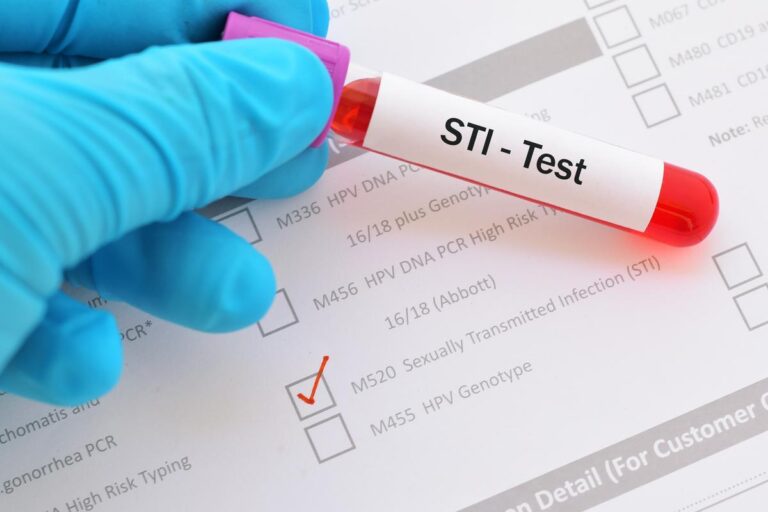 sti screening